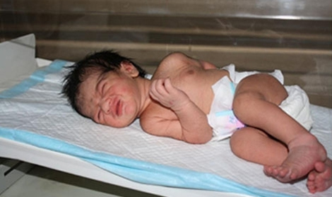 The unwanted newborn that was dropped in the Chhipa Palna (Cradle) had fully recovered